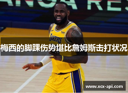 梅西的脚踝伤势堪比詹姆斯击打状况